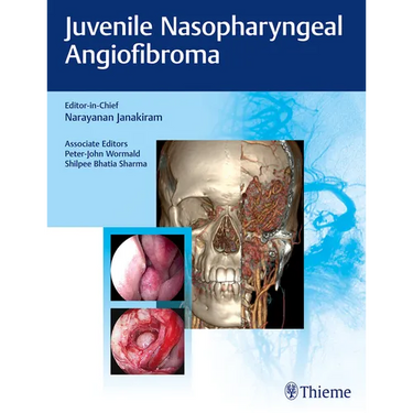 Juvenile Nasopharyngeal Angiofibroma