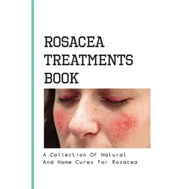 Rosacea Treatments Book- A Collection Of Natural And Home Cures For Rosacea: Rosacea Treatment