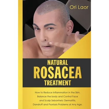 Natural Rosacea Treatment: How to Reduce Inflammation in the Skin, Balance the body and Control Face and Scalp Seborrheic Dermatitis, Dandruff an