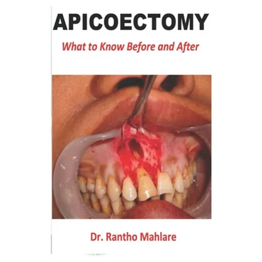 Apicoectomy: What to Know Before and After