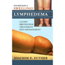 It's Not Just a Swelling! Lymphedema: Causes, Prevention, Treatment, Self-Management