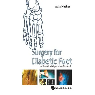 Surgery for Diabetic Foot
