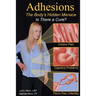 Adhesions: The Body's Inner Menace - Is There a Cure?