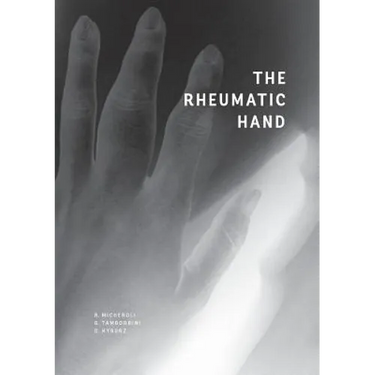 The Rheumatic Hand