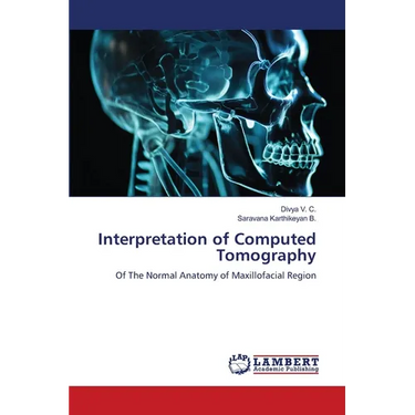 Interpretation of Computed Tomography
