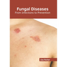 Fungal Diseases: From Infections to Prevention