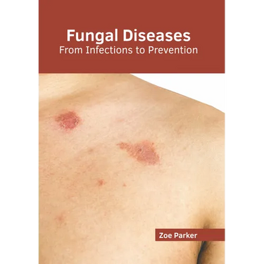 Fungal Diseases: From Infections to Prevention