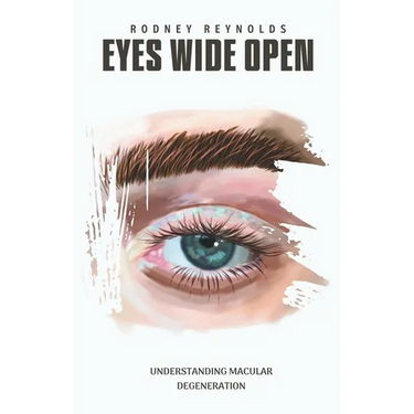 Eyes Wide Open: Understanding Macular Degeneration