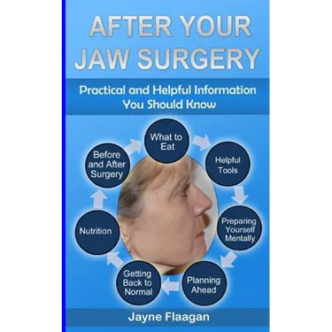 After Your Jaw Surgery: Practical and Helpful Information You Should Know