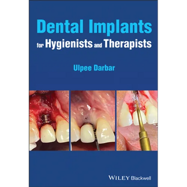 Dental Implants for Hygienists and Therapists