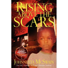 Rising Above the Scars