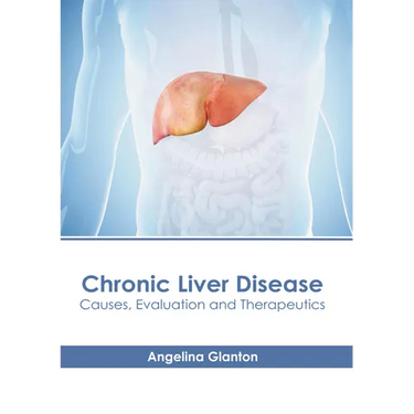 Chronic Liver Disease: Causes, Evaluation and Therapeutics
