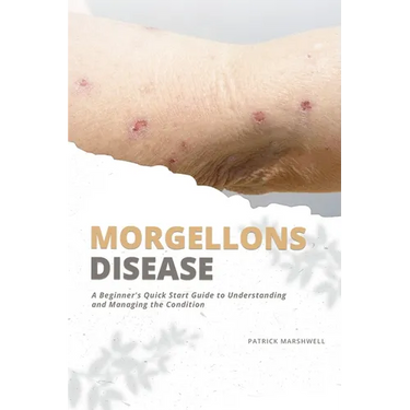 Morgellons Disease: A Beginner's Quick Start Guide to Understanding and Managing the Condition