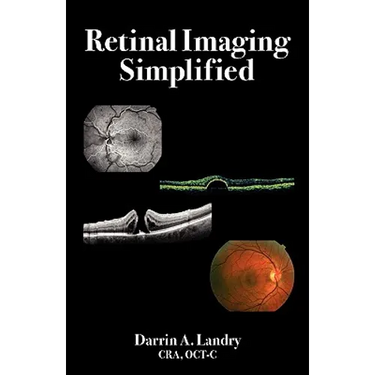 Retinal Imaging Simplified