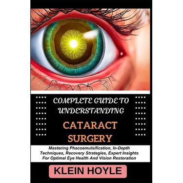 Complete Guide to Understanding Cataract Surgery: Mastering Phacoemulsification, In-Depth Techniques, Recovery Strategies, Expert Insights For Optimal