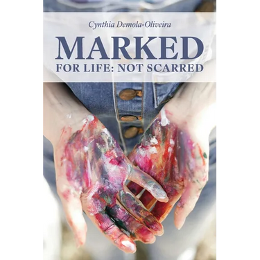Marked for Life: Not Scarred