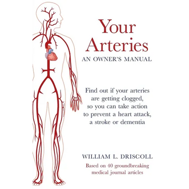 Your Arteries-An Owner's Manual: Find out if your arteries are getting clogged, so you can take action to prevent a heart attack, a stroke or dementia