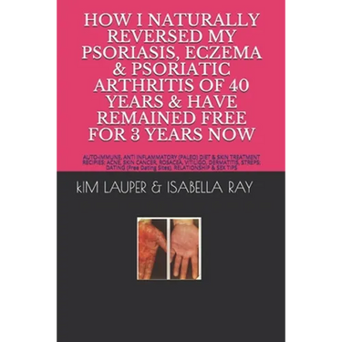 How I Naturally Reversed My Psoriasis, Eczema and Psoriatic Arthritis of 40 Years and Have Remained Free for 3 Years Now: AUTO IMMUNE, GLUTEN FREE, DA