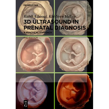3D Ultrasound in Prenatal Diagnosis: A Practical Approach
