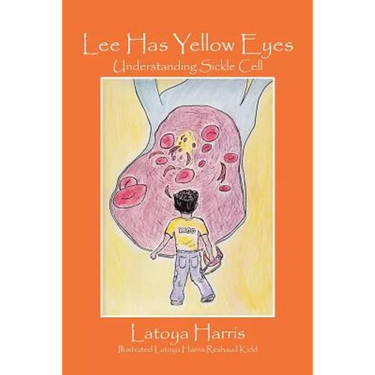 Lee Has Yellow Eyes: Understanding Sickle Cell