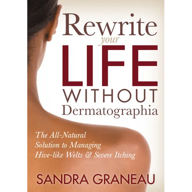 Rewrite Your Life Without Dermatographia: The All-Natural Solution to Managing Hive-Like Welts and Severe Itching