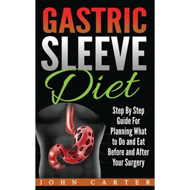 Gastric Sleeve Diet: Step By Step Guide For Planning What to Do and Eat Before and After Your Surgery