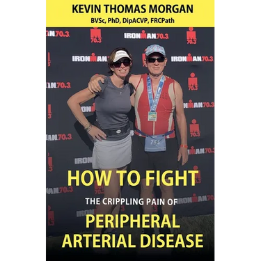 How to Fight The Crippling Pain of Peripheral Arterial Disease