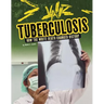 Tuberculosis: How the White Death Changed History