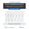 Essential Concepts of Electrophysiology Through Case Studies: Intracardiac EGMs: Intracardiac EGMs