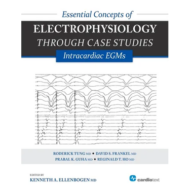 Essential Concepts of Electrophysiology Through Case Studies: Intracardiac EGMs: Intracardiac EGMs