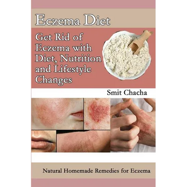 Eczema Diet - Get Rid of Eczema with Diet, Nutrition and Lifestyle Changes: Natural Homemade Remedies for Eczema