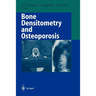 Bone Densitometry and Osteoporosis