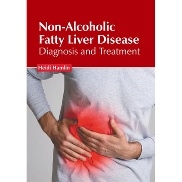 Non-Alcoholic Fatty Liver Disease: Diagnosis and Treatment