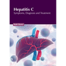 Hepatitis C: Symptoms, Diagnosis and Treatment