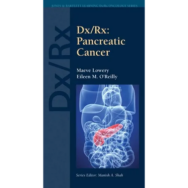 DX/Rx: Pancreatic Cancer: Pancreatic Cancer
