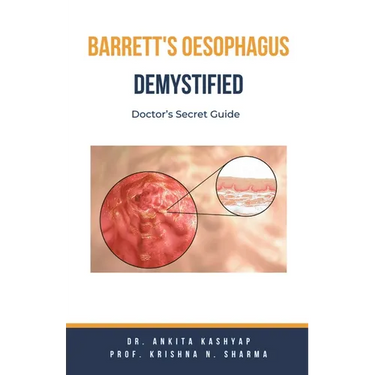 Barretts Oesophagus Demystified: Doctor's Secret Guide