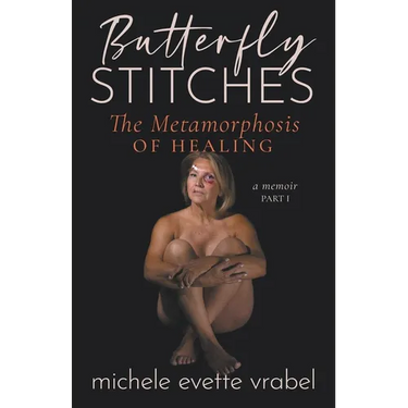 Butterfly Stitches: The Metamorphosis of Healing