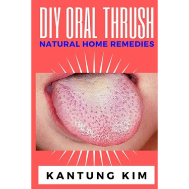 DIY Oral Thrush Natural Home Remedies: The Effective Step By Step Guide To Permanently End Oral Thrush