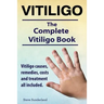 Vitiligo. Vitiligo causes, remedies, costs and treatment all included. The complete Vitiligo Book.