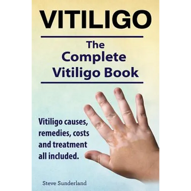 Vitiligo. Vitiligo causes, remedies, costs and treatment all included. The complete Vitiligo Book.