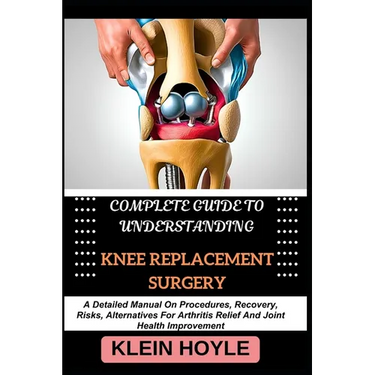 Complete Guide to Understanding Knee Replacement Surgery: A Detailed Manual On Procedures, Recovery, Risks, Alternatives For Arthritis Relief And Join