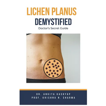 Lichen Planus Demystified Doctors Secret Guide