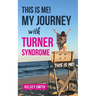 This is ME!: My Journey with Turner Syndrome
