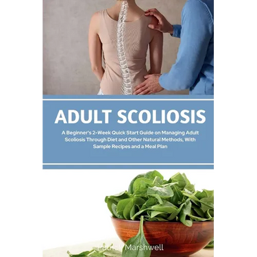 Adult Scoliosis: A Beginner's 2-Week Quick Start Guide on Managing Adult Scoliosis Through Diet and Other Natural Methods, With Sample Recipes and a M
