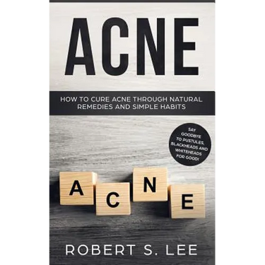Acne: How to Cure Acne through Natural Remedies and Simple Habits. Say Goodbye to Pustules, Blackheads and Whiteheads for Good!