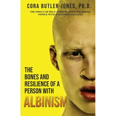 The Bones and Resilience of a Person with Albinism