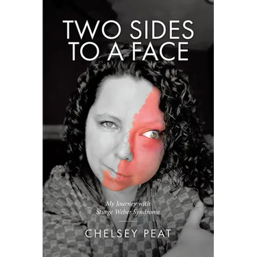 Two Sides to a Face: My Journey with Sturge Weber Syndrome