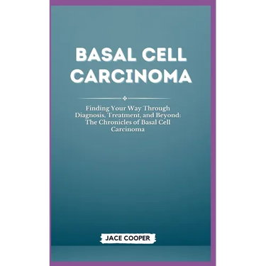Basal Cell Carcinoma: Finding Your Way Through Diagnosis, Treatment, and Beyond: The Chronicles of Basal Cell Carcinoma