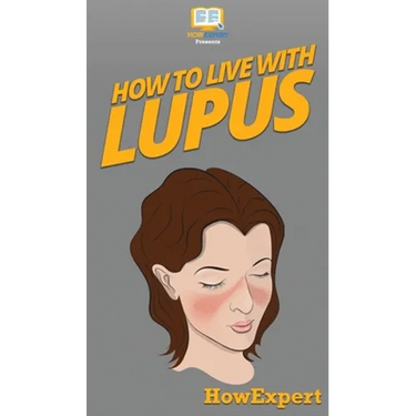 How To Live With Lupus: Your Step By Step Guide To Living With Lupus
