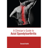 A Clinician's Guide to Axial Spondyloarthritis
